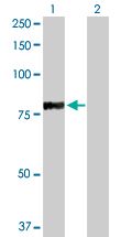 Western blot - RFX5 overexpression 293T lysate (whole cell) (AB94108), expandable thumbnail