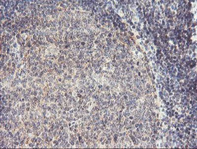 Immunohistochemistry (Formalin/PFA-fixed paraffin-embedded sections) - Anti-RFXANK antibody [OTI3E7] (AB236408)