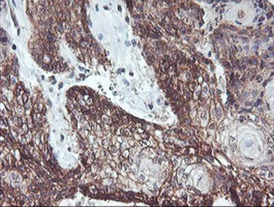 Immunohistochemistry (Formalin/PFA-fixed paraffin-embedded sections) - Anti-RFXANK antibody [OTI3E7] (AB236408)