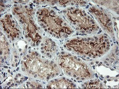 Immunohistochemistry (Formalin/PFA-fixed paraffin-embedded sections) - Anti-RFXANK antibody [OTI3E7] (AB236408)