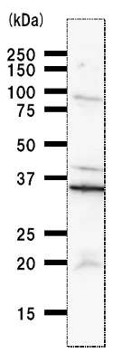 Western blot - Anti-RFXAP antibody [RFXAD55A] (AB51376)