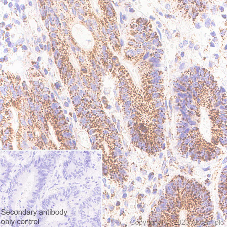 Immunohistochemistry (Formalin/PFA-fixed paraffin-embedded sections) - Anti-RG9MTD1 antibody [EPR27065-61] (AB313372)