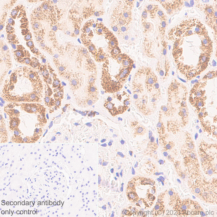 Immunohistochemistry (Formalin/PFA-fixed paraffin-embedded sections) - Anti-RG9MTD1 antibody [EPR27065-61] - BSA and Azide free (AB313373), expandable thumbnail