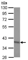 Western blot - Anti-RG9MTD2 antibody (AB127687)