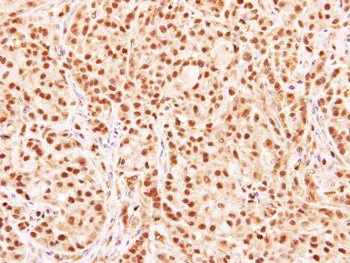 Immunohistochemistry (Formalin/PFA-fixed paraffin-embedded sections) - Anti-RG9MTD3 antibody (AB151975)