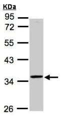 Western blot - Anti-RG9MTD3 antibody (AB151975)
