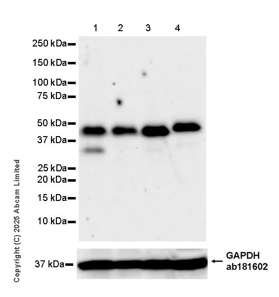 Western blot - Anti-RG9MTD3 antibody [EPR28590-15] (AB324235)