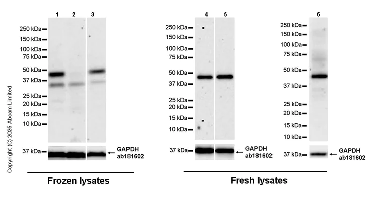 Western blot - Anti-RG9MTD3 antibody [EPR28590-15] (AB324235)