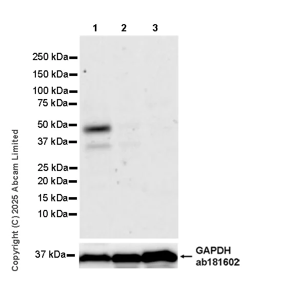 Western blot - Anti-RG9MTD3 antibody [EPR28590-15] (AB324235)