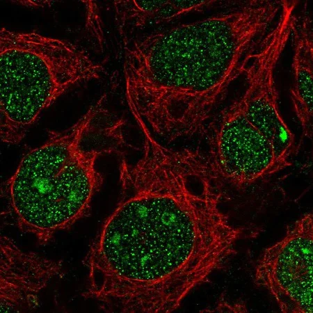 Immunocytochemistry/ Immunofluorescence - Anti-RGC-32 antibody (AB221098)
