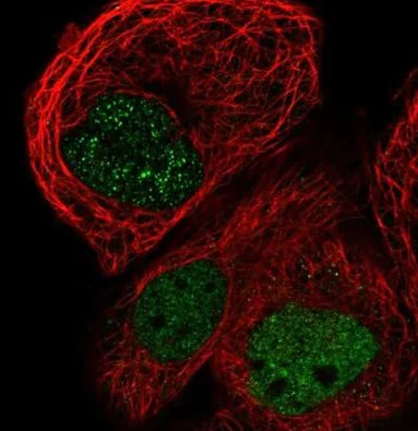 Immunocytochemistry/ Immunofluorescence - Anti-RGD1310794 antibody (AB224465)