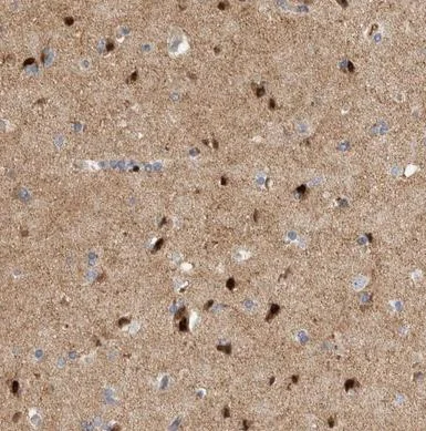 Immunohistochemistry (Formalin/PFA-fixed paraffin-embedded sections) - Anti-RGD1310794 antibody (AB224465)