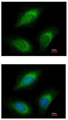 Immunocytochemistry/ Immunofluorescence - Anti-RGL2 antibody (AB137600)