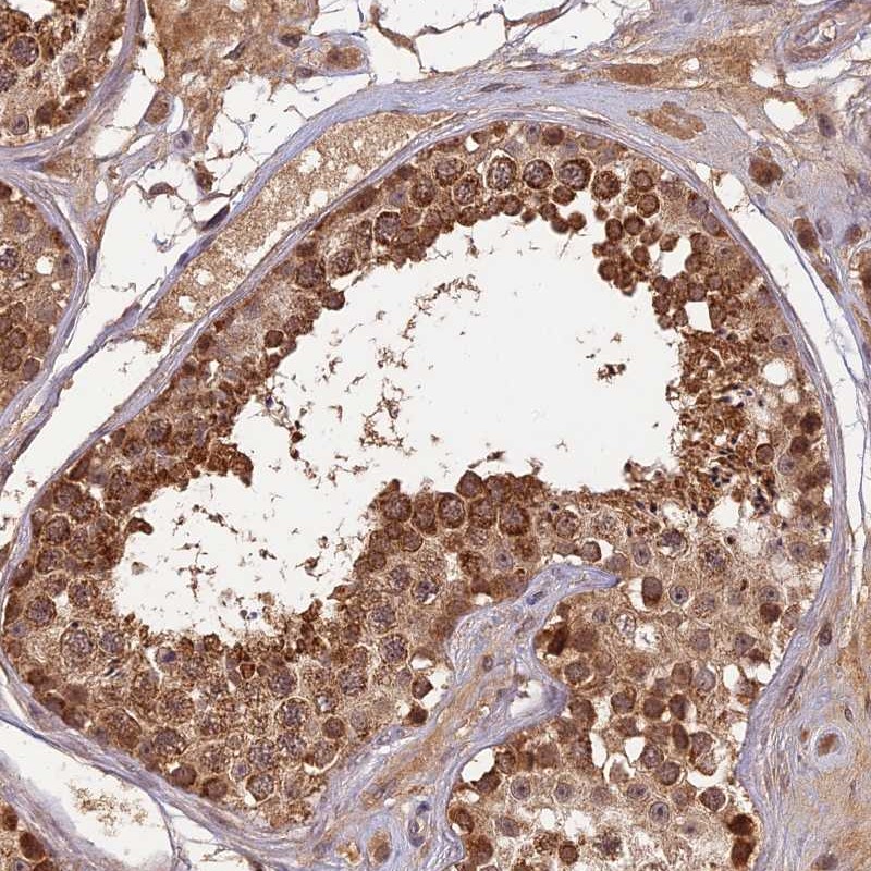 Immunohistochemistry (Formalin/PFA-fixed paraffin-embedded sections) - Anti-RGL3 antibody (AB254821)