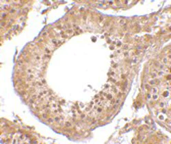 Immunohistochemistry (Formalin/PFA-fixed paraffin-embedded sections) - Anti-RGPD5 antibody (AB106360)