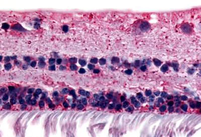 Immunohistochemistry (Formalin/PFA-fixed paraffin-embedded sections) - Anti-RGR antibody (AB188948)