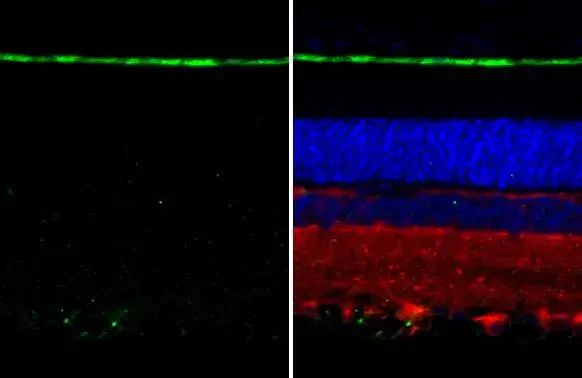 Immunohistochemistry (Formalin/PFA-fixed paraffin-embedded sections) - Anti-RGR antibody [HL3058] - BSA and Azide free (AB325872)