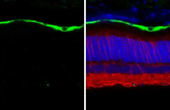 Immunohistochemistry (Formalin/PFA-fixed paraffin-embedded sections) - Anti-RGR antibody [HL3058] - BSA and Azide free (AB325872)