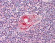 Immunohistochemistry (Formalin/PFA-fixed paraffin-embedded sections) - Anti-RGS1 antibody (AB117077)