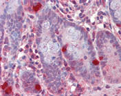 Immunohistochemistry (Formalin/PFA-fixed paraffin-embedded sections) - Anti-RGS1 antibody (AB117077)