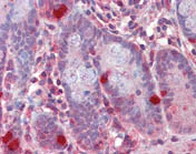 Immunohistochemistry (Formalin/PFA-fixed paraffin-embedded sections) - Anti-RGS1 antibody (AB117077)