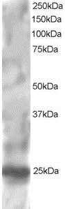 Western blot - Anti-RGS1 antibody (AB117077)