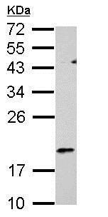 Western blot - Anti-RGS1 antibody (AB154973), expandable thumbnail