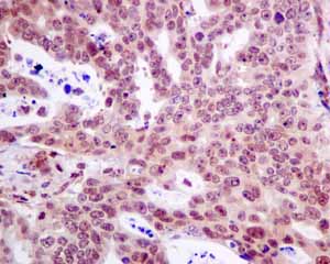 Immunohistochemistry (Formalin/PFA-fixed paraffin-embedded sections) - Anti-RGS10 antibody [EPR10657(B)] (AB154172)