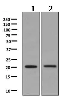 Western blot - Anti-RGS10 antibody [EPR10657(B)] (AB154172)