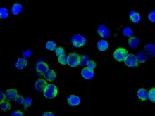 Immunocytochemistry/ Immunofluorescence - Anti-RGS10 antibody [EPR10657(B)] - BSA and Azide free (AB249072)