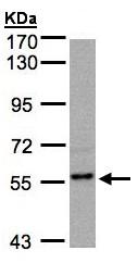 Western blot - Anti-RGS14 antibody (AB96674), expandable thumbnail