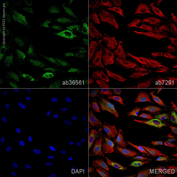 Immunocytochemistry/ Immunofluorescence - Anti-RGS2 antibody (AB36561)