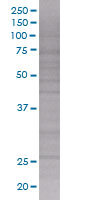 SDS-PAGE - RGS2 overexpression 293T lysate (whole cell) (AB94228), expandable thumbnail