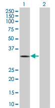 Western blot - RGS2 overexpression 293T lysate (whole cell) (AB94228), expandable thumbnail