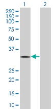 Western blot - RGS2 overexpression 293T lysate (whole cell) (AB94228)