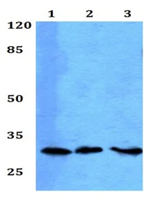 Western blot - Anti-RGS20 antibody (AB191500)