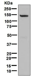Western blot - Anti-RGS22 antibody [EPR7005] (AB131048)