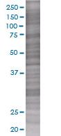 RGS3 overexpression 293T lysate (whole cell)