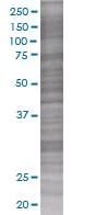 SDS-PAGE - RGS3 overexpression 293T lysate (whole cell) (AB94242)