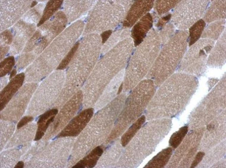 Immunohistochemistry (Formalin/PFA-fixed paraffin-embedded sections) - Anti-RGS4 antibody (AB97307), expandable thumbnail