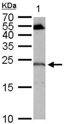 Western blot - Anti-RGS4 antibody (AB97307), expandable thumbnail