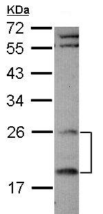 Western blot - Anti-RGS4 antibody (AB97307), expandable thumbnail