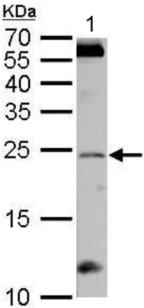 Western blot - Anti-RGS4 antibody (AB97307)