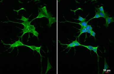 Immunocytochemistry/ Immunofluorescence - Anti-RGS4 antibody [HL1522] (AB308160)