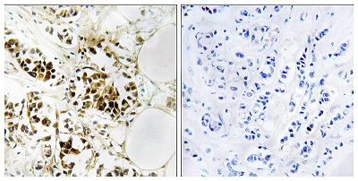 Immunohistochemistry (Formalin/PFA-fixed paraffin-embedded sections) - Anti-RGS5 antibody (AB196799)