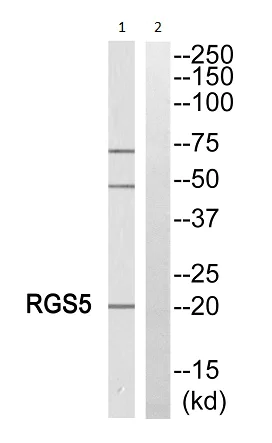 Western blot - Anti-RGS5 antibody (AB196799)