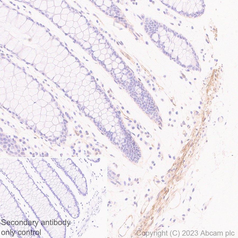 Immunohistochemistry (Formalin/PFA-fixed paraffin-embedded sections) - Anti-RGS5 antibody [EPR28539-64] (ab314670), expandable thumbnail