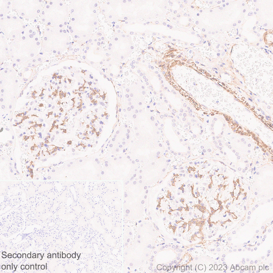 Immunohistochemistry (Formalin/PFA-fixed paraffin-embedded sections) - Anti-RGS5 antibody [EPR28539-64] (ab314670), expandable thumbnail