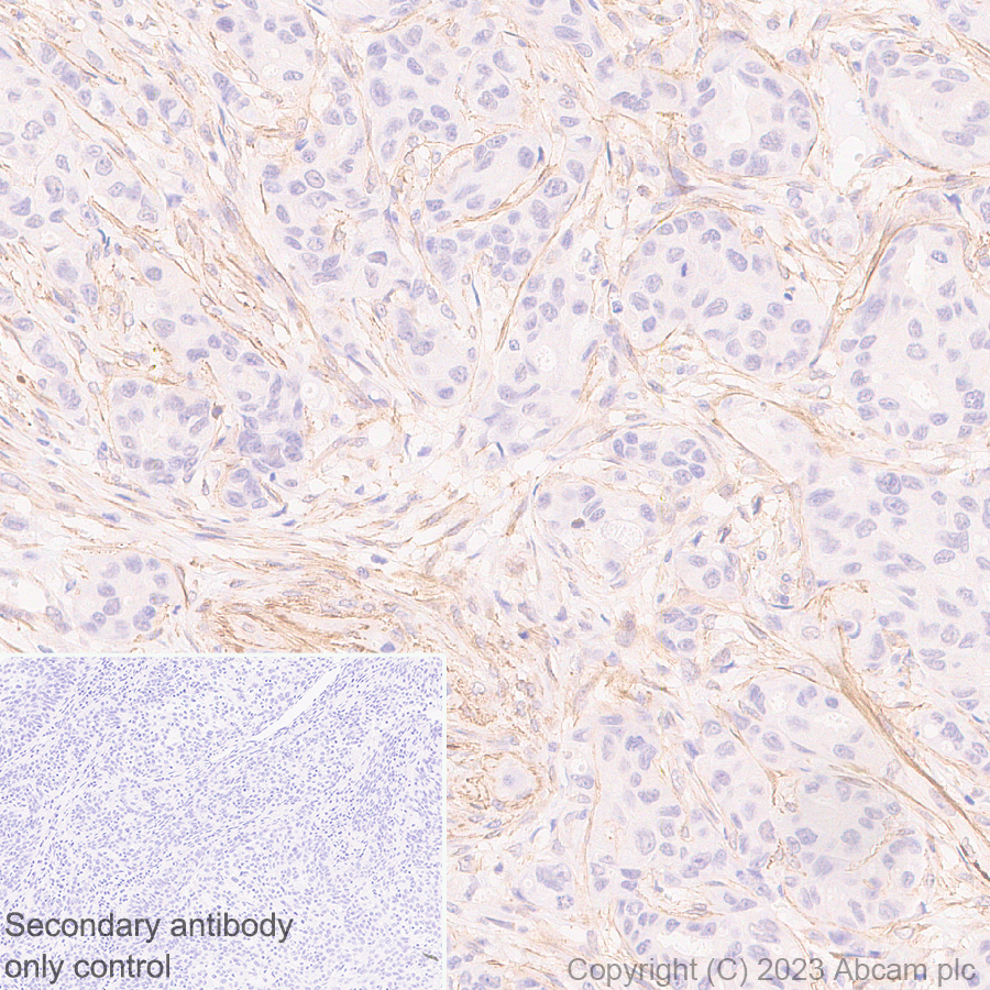 Immunohistochemistry (Formalin/PFA-fixed paraffin-embedded sections) - Anti-RGS5 antibody [EPR28539-64] (ab314670), expandable thumbnail