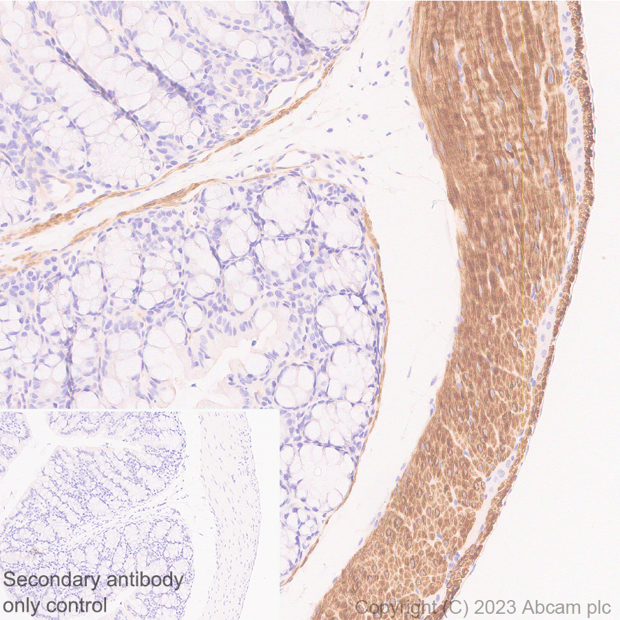 Immunohistochemistry (Formalin/PFA-fixed paraffin-embedded sections) - Anti-RGS5 antibody [EPR28539-64] (ab314670), expandable thumbnail